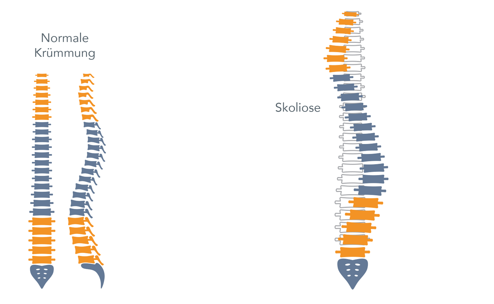 Skoliose | AtlasreflexTh.